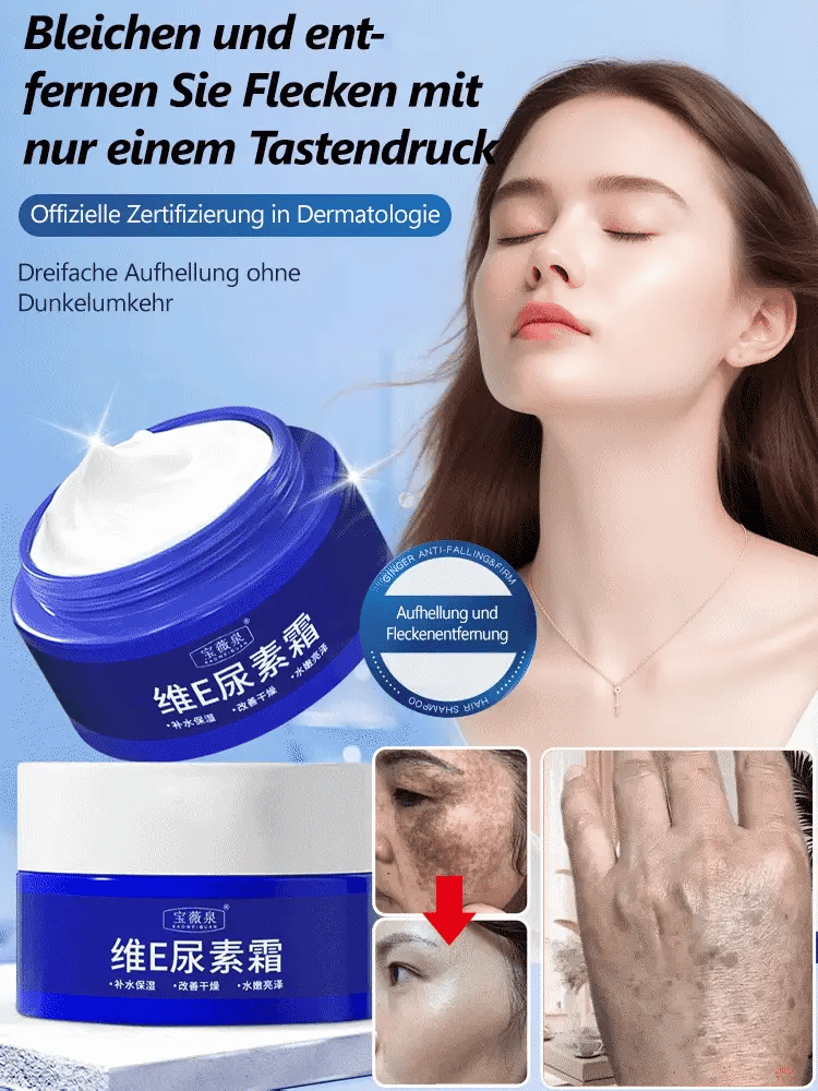 Stain Lightening Urea Cream