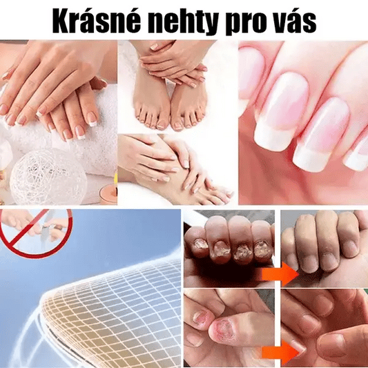 Nail treatment cream