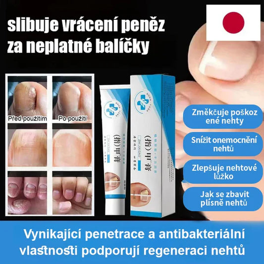 Nail treatment cream